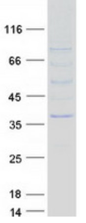 SDS PAGE (NMNAT2-5467H).jpg